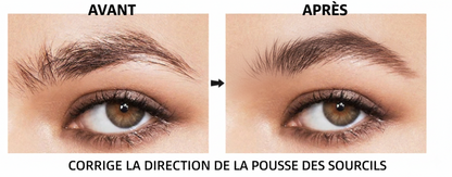Browlift sourcils coréen
