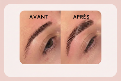 Browlift sourcils coréen